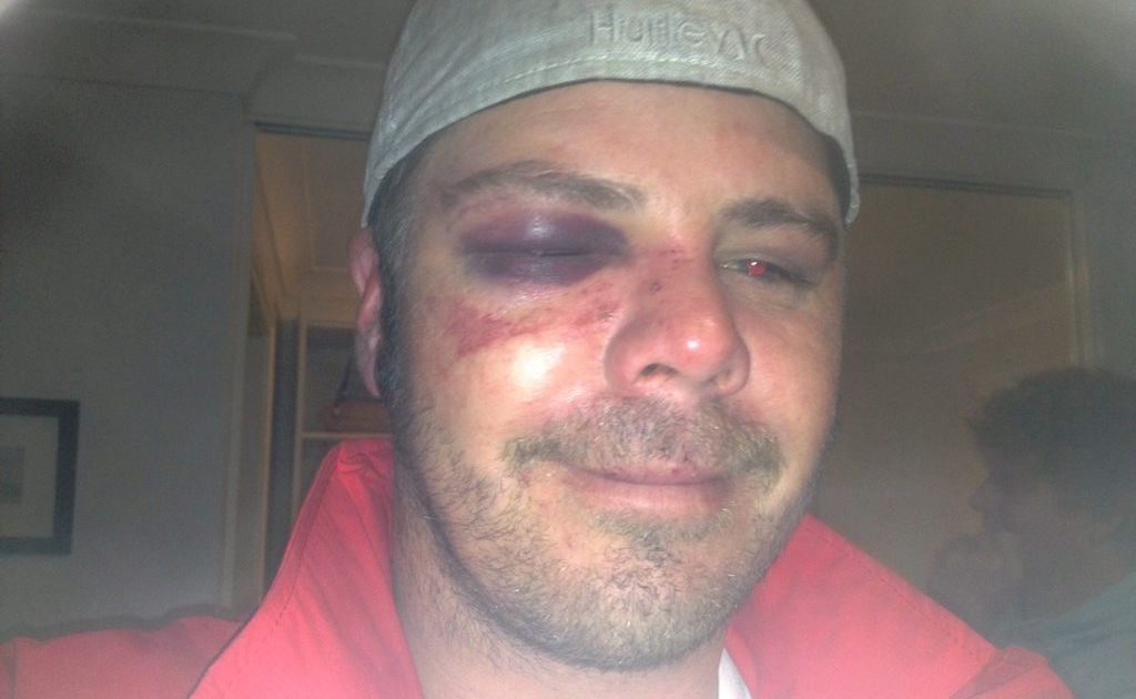 Bashing victim Drew Atkins. Bashing victim Drew Atkins.